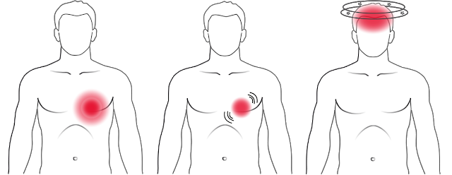 Signs, And Symptoms Of Arrhythmias
